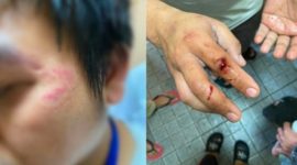 Foto: Korban Kekerasan 