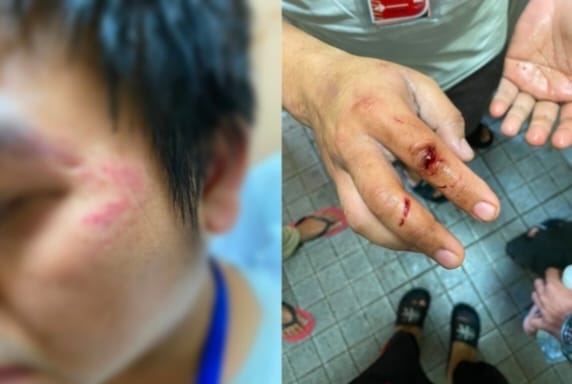 Foto: Korban Kekerasan 